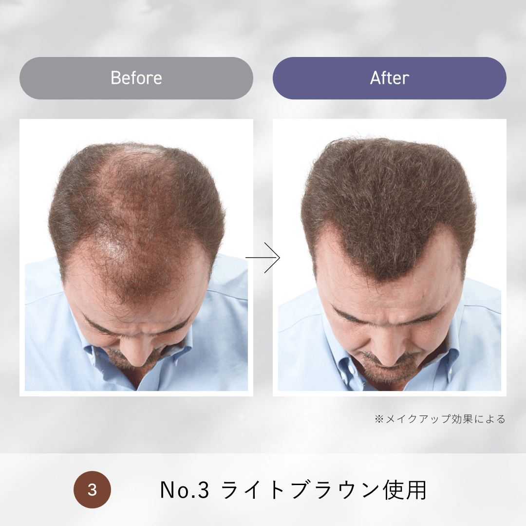 SPミリオンヘアー コンパクトセット#3ライトブラウン スーパーミリオンヘアー SMH ヘアファンデーション No.3 ライト