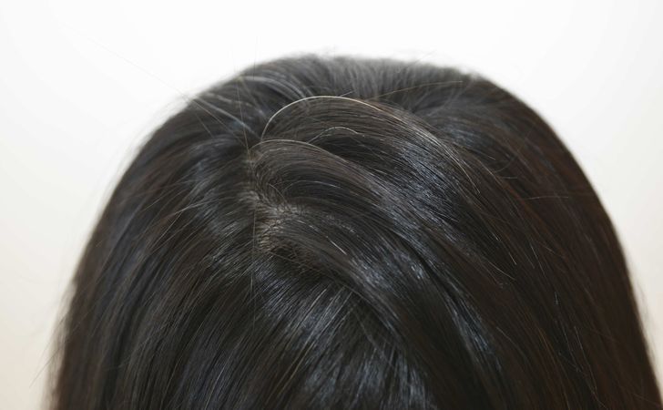 産後の白髪は元に戻るの？